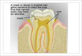 Dental care India