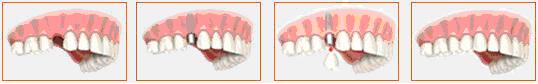 Dental care India