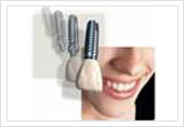 Dental care India